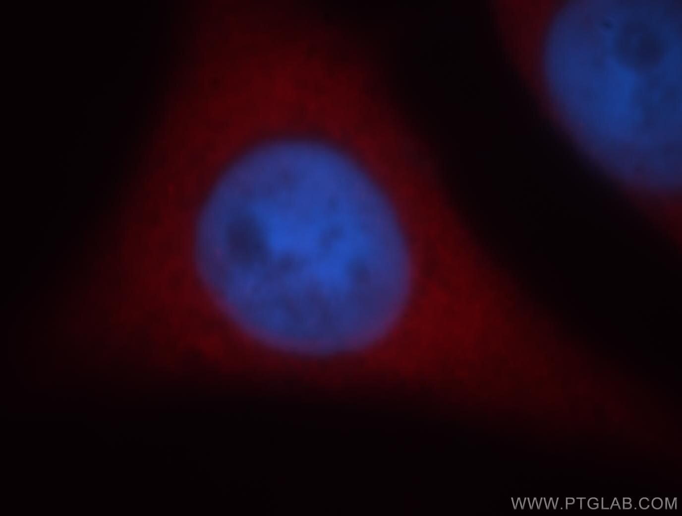Immunofluorescence (IF) / fluorescent staining of HeLa cells using MTPN Polyclonal antibody (13508-1-AP)