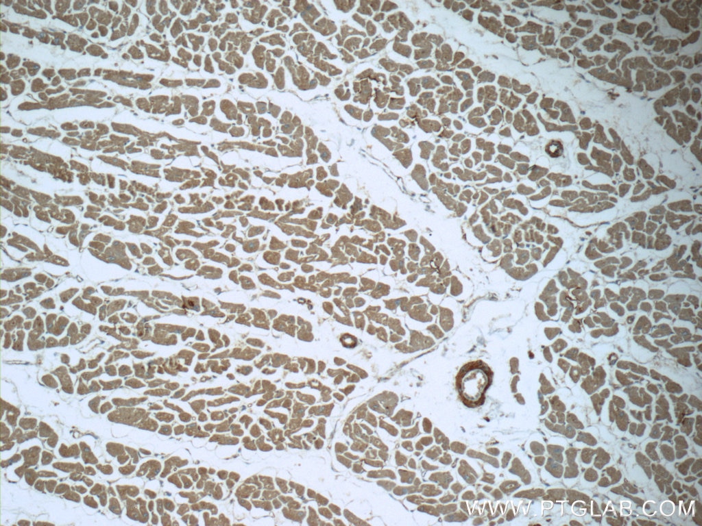 Immunohistochemistry (IHC) staining of human heart tissue using MTPN Polyclonal antibody (13508-1-AP)