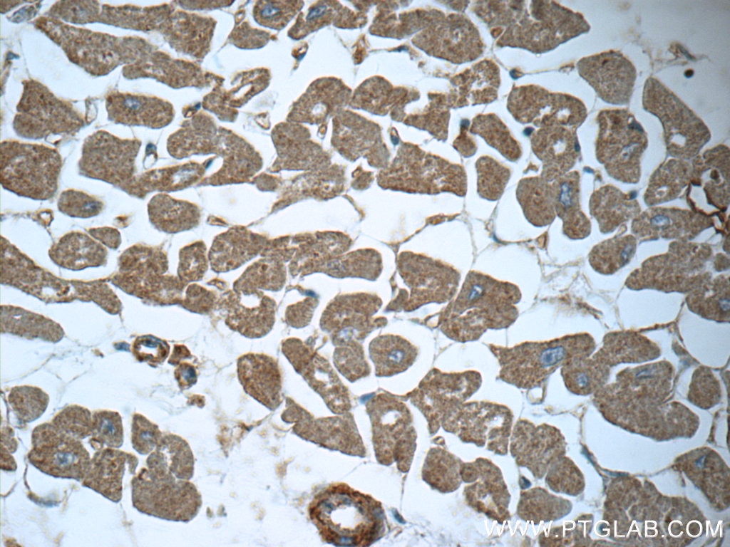 Immunohistochemistry (IHC) staining of human heart tissue using MTPN Polyclonal antibody (13508-1-AP)