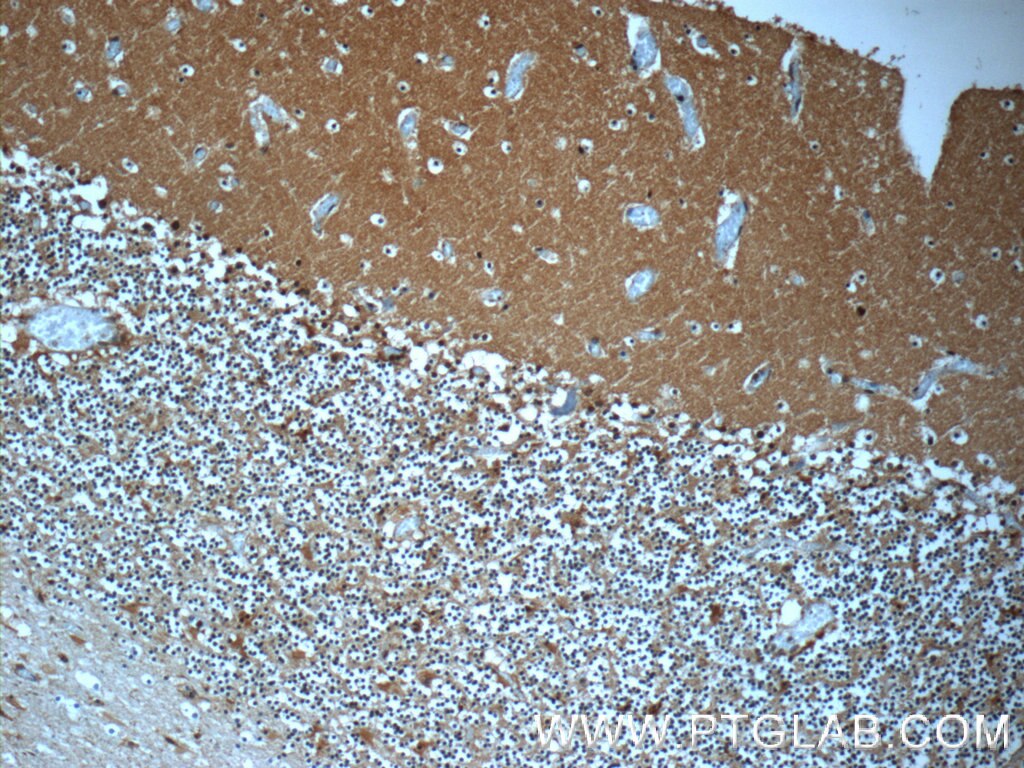 IHC staining of human cerebellum using 13508-1-AP