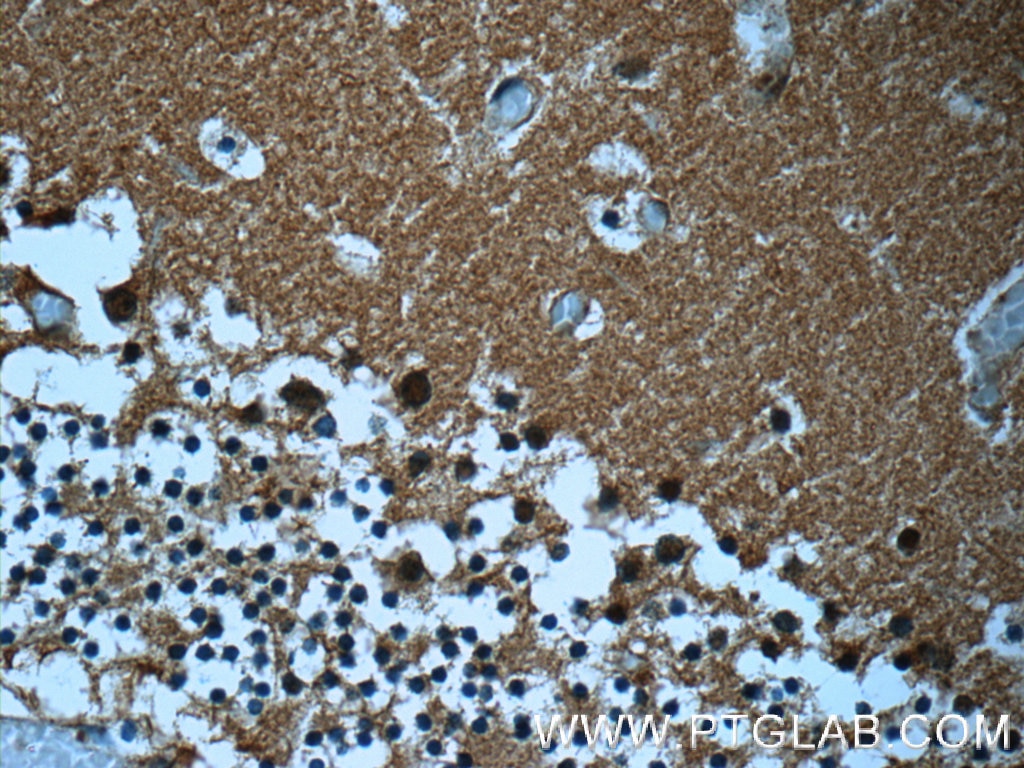 IHC staining of human cerebellum using 13508-1-AP