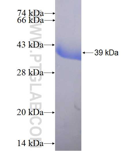MTPN fusion protein Ag4419 SDS-PAGE