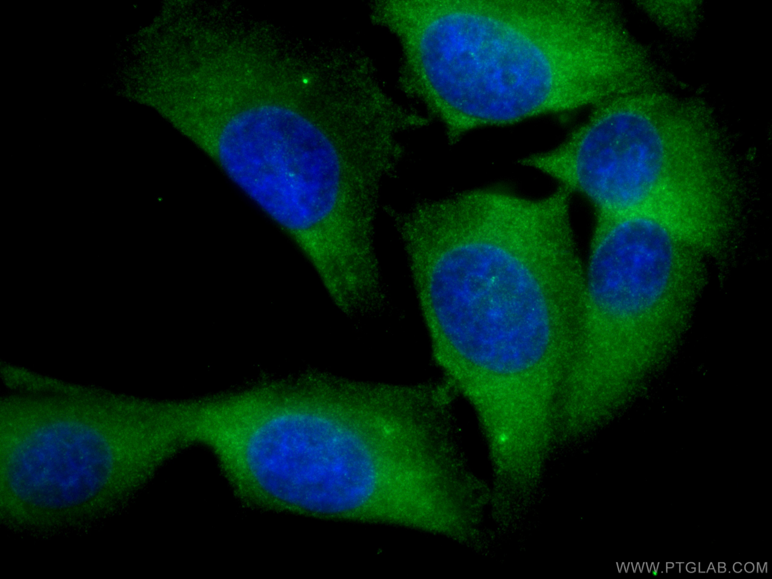 Immunofluorescence (IF) / fluorescent staining of A375 cells using MTR Polyclonal antibody (25896-1-AP)