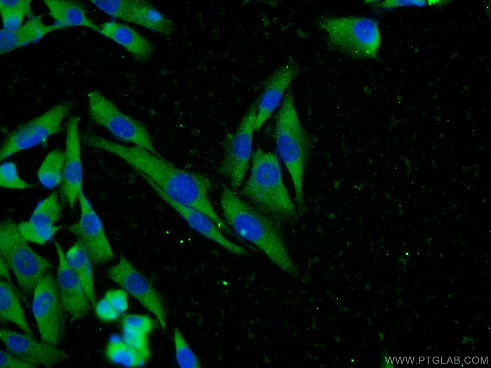 Immunofluorescence (IF) / fluorescent staining of A375 cells using MTR Polyclonal antibody (25896-1-AP)