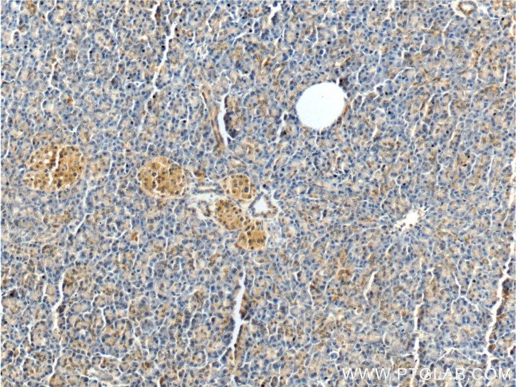 Immunohistochemistry (IHC) staining of human pancreas tissue using MTR Polyclonal antibody (25896-1-AP)