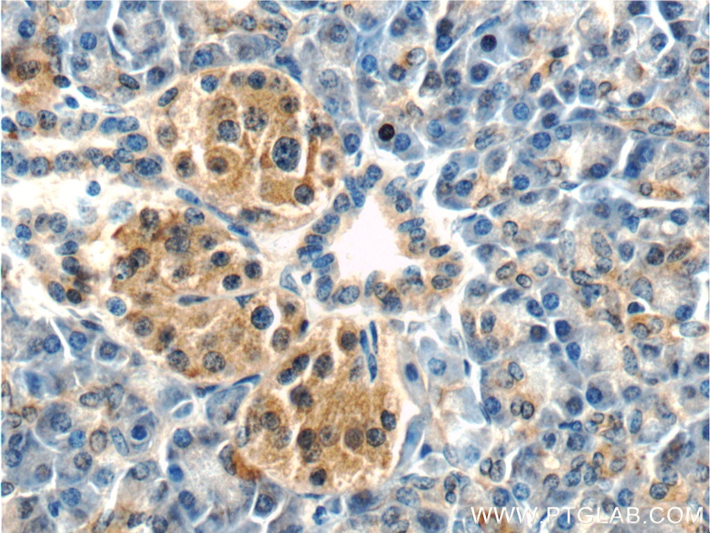 Immunohistochemistry (IHC) staining of human pancreas tissue using MTR Polyclonal antibody (25896-1-AP)