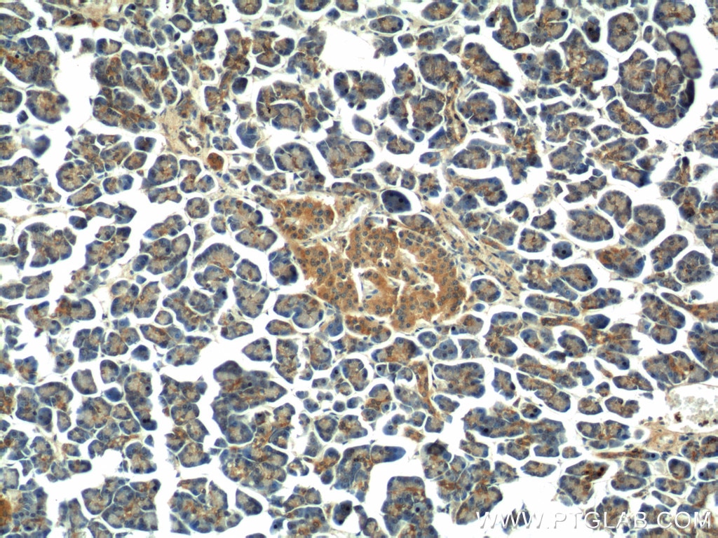 Immunohistochemistry (IHC) staining of human pancreas tissue using MTR Polyclonal antibody (25896-1-AP)