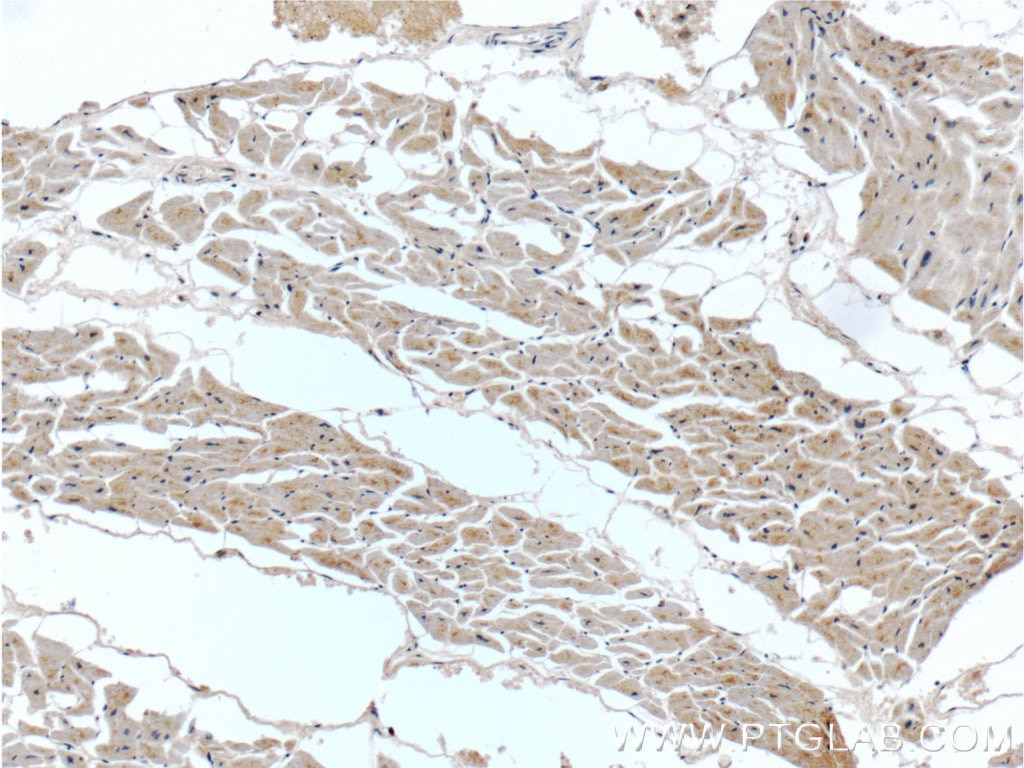 Immunohistochemistry (IHC) staining of human heart tissue using MTR Polyclonal antibody (25896-1-AP)