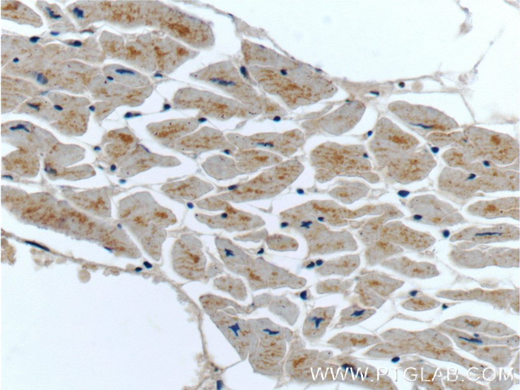 Immunohistochemistry (IHC) staining of human heart tissue using MTR Polyclonal antibody (25896-1-AP)