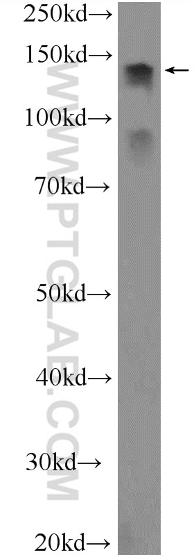 WB analysis of mouse pancreas using 25896-1-AP