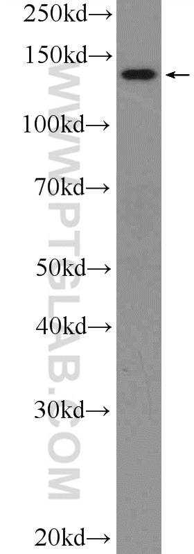 Western Blot (WB) analysis of A375 cells using MTR Polyclonal antibody (25896-1-AP)