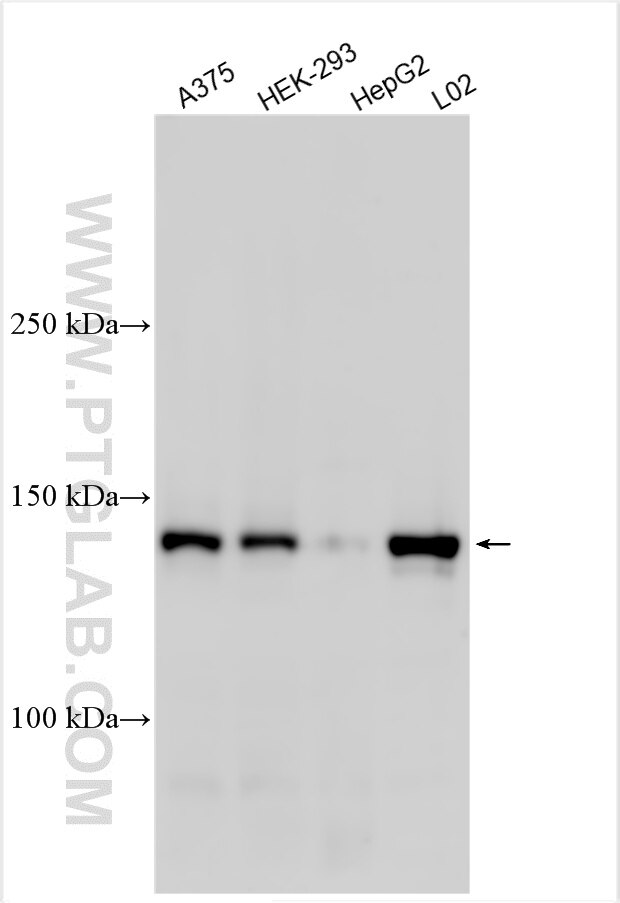 Western Blot (WB) analysis of various lysates using MTR Polyclonal antibody (25896-1-AP)