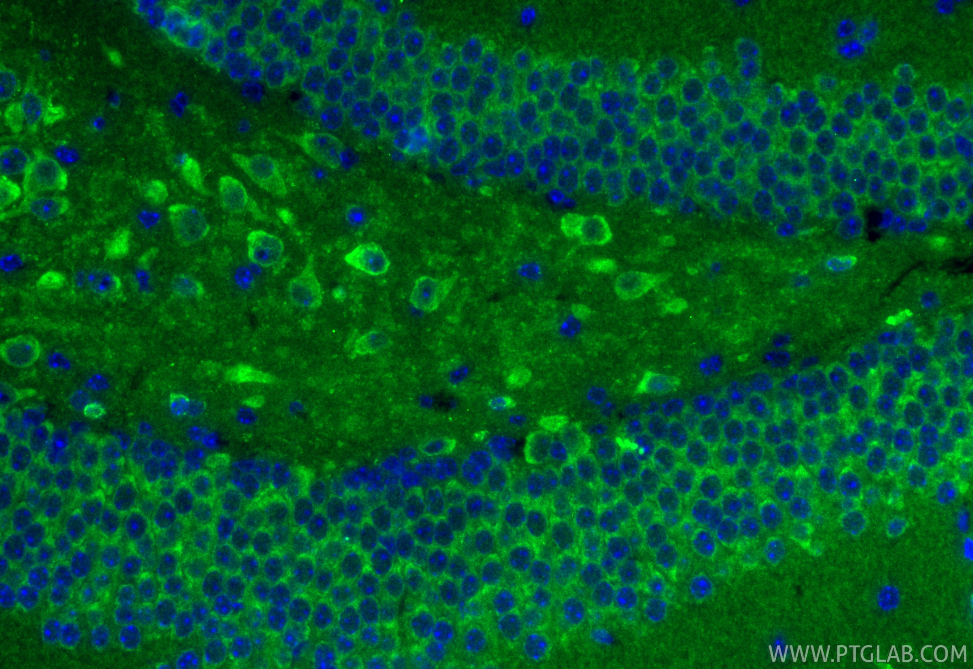 IF Staining of mouse brain using 11581-1-AP (same clone as 11581-1-PBS) Immunofluorescence (IF) / fluorescent staining of mouse brain tissue using MTRF1 Polyclonal antibody (11581-1-AP)