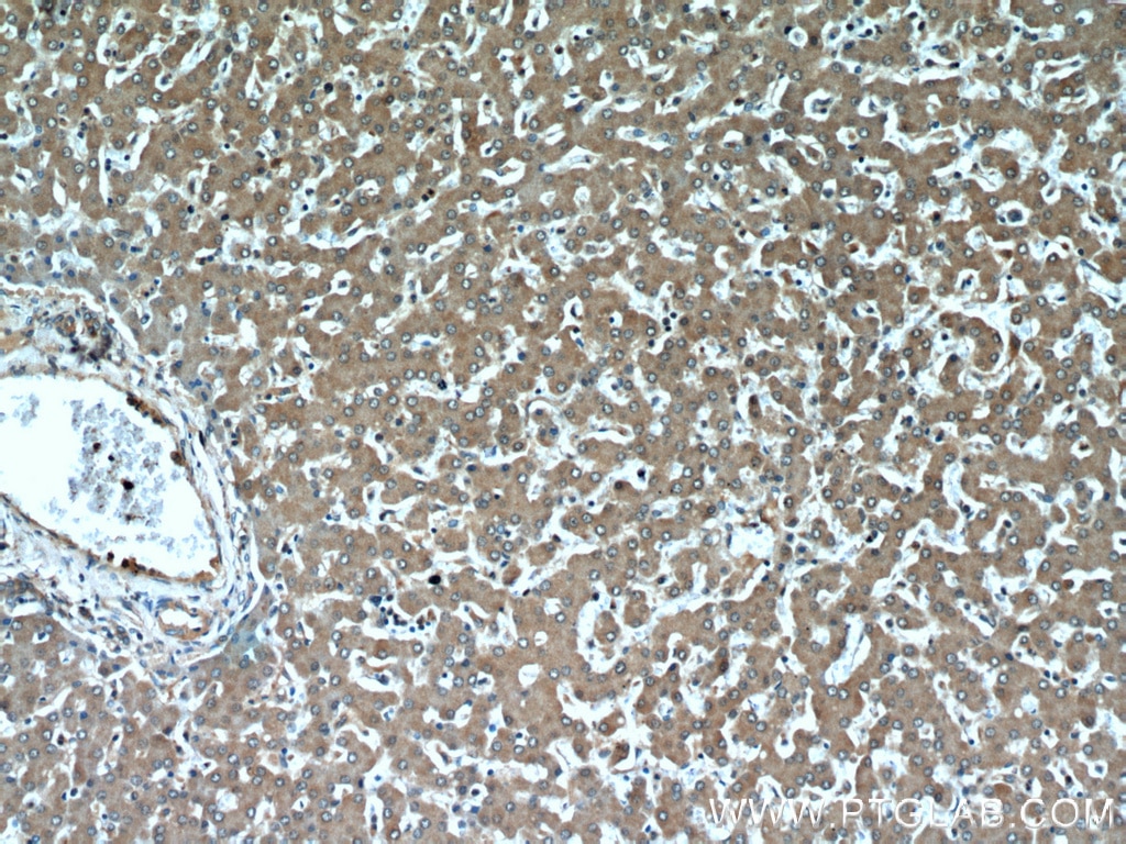 Immunohistochemistry (IHC) staining of human liver tissue using MTRF1 Polyclonal antibody (11581-1-AP)