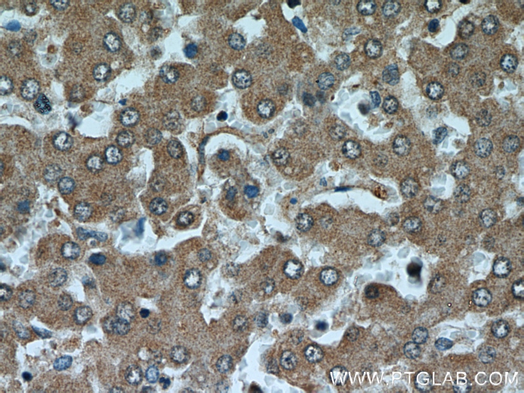 Immunohistochemistry (IHC) staining of human liver tissue using MTRF1 Polyclonal antibody (11581-1-AP)
