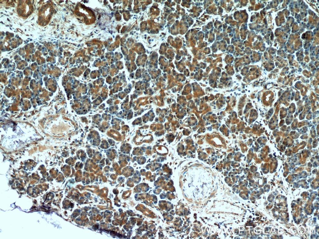 Immunohistochemistry (IHC) staining of human pancreas tissue using MTRF1 Polyclonal antibody (11581-1-AP)