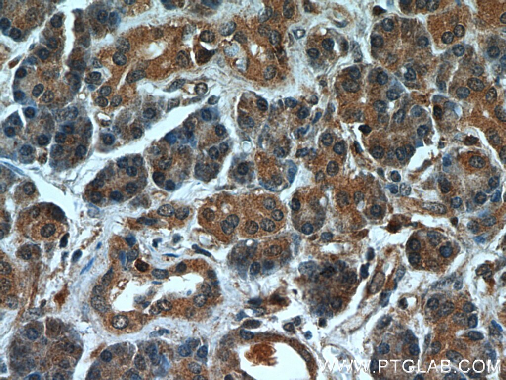 IHC staining of human pancreas using 11581-1-AP