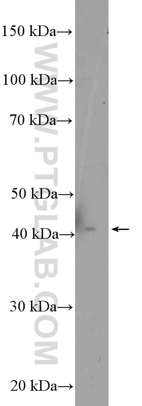 Western Blot (WB) analysis of HEK-293 cells using MTRF1L Polyclonal antibody (16694-1-AP)