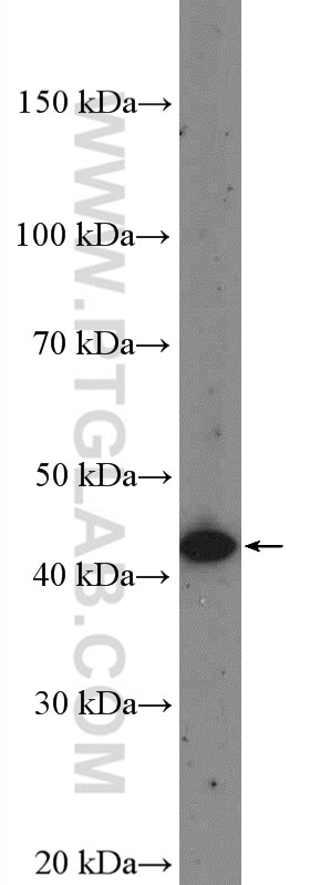 Western Blot (WB) analysis of HeLa cells using MTRF1L Polyclonal antibody (16694-1-AP)