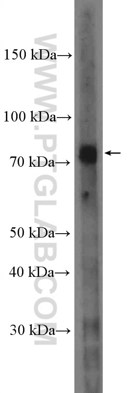 Western Blot (WB) analysis of K-562 cells using MTRR Polyclonal antibody (26944-1-AP)