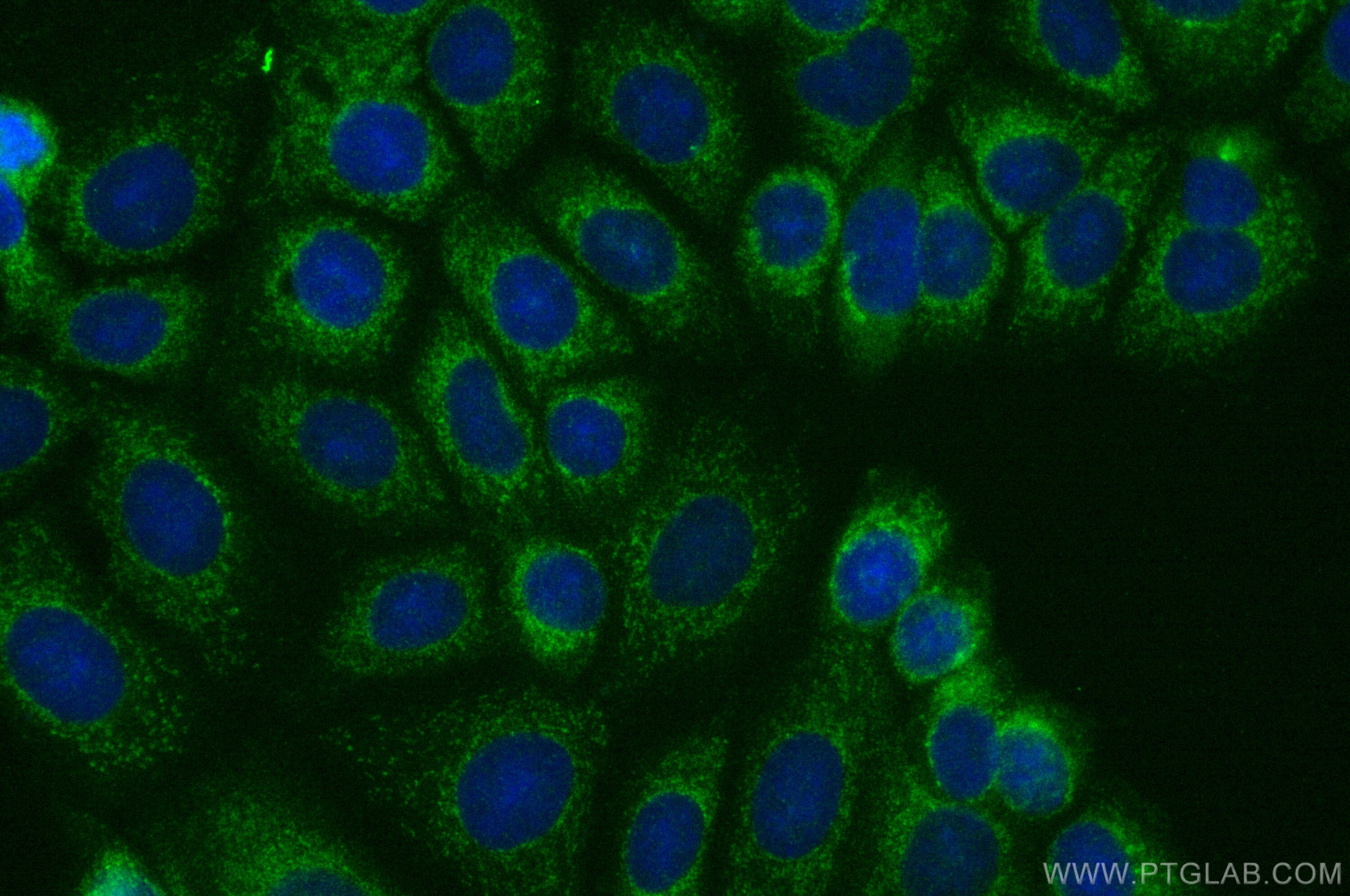 Immunofluorescence (IF) / fluorescent staining of MCF-7 cells using MTSS1 Polyclonal antibody (13995-1-AP)