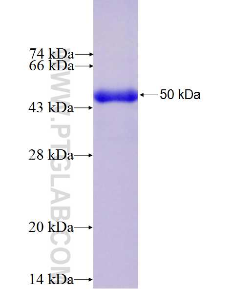 MTSS1 fusion protein Ag27217 SDS-PAGE