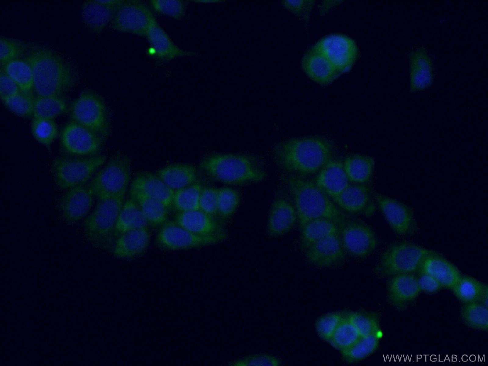 Immunofluorescence (IF) / fluorescent staining of MCF-7 cells using MTSS1L Polyclonal antibody (27832-1-AP)