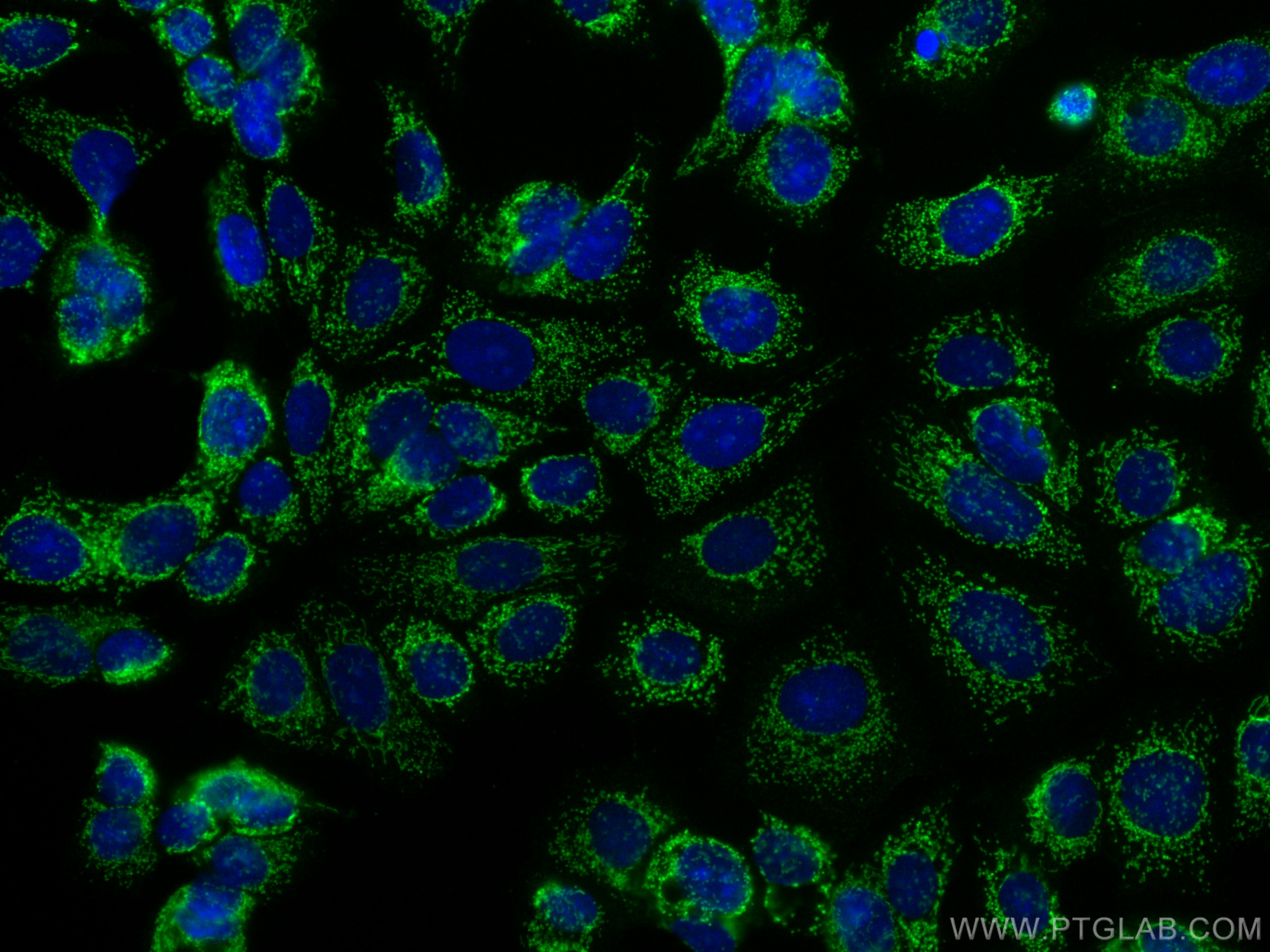 Immunofluorescence (IF) / fluorescent staining of MCF-7 cells using MTSS1L Polyclonal antibody (27832-1-AP)