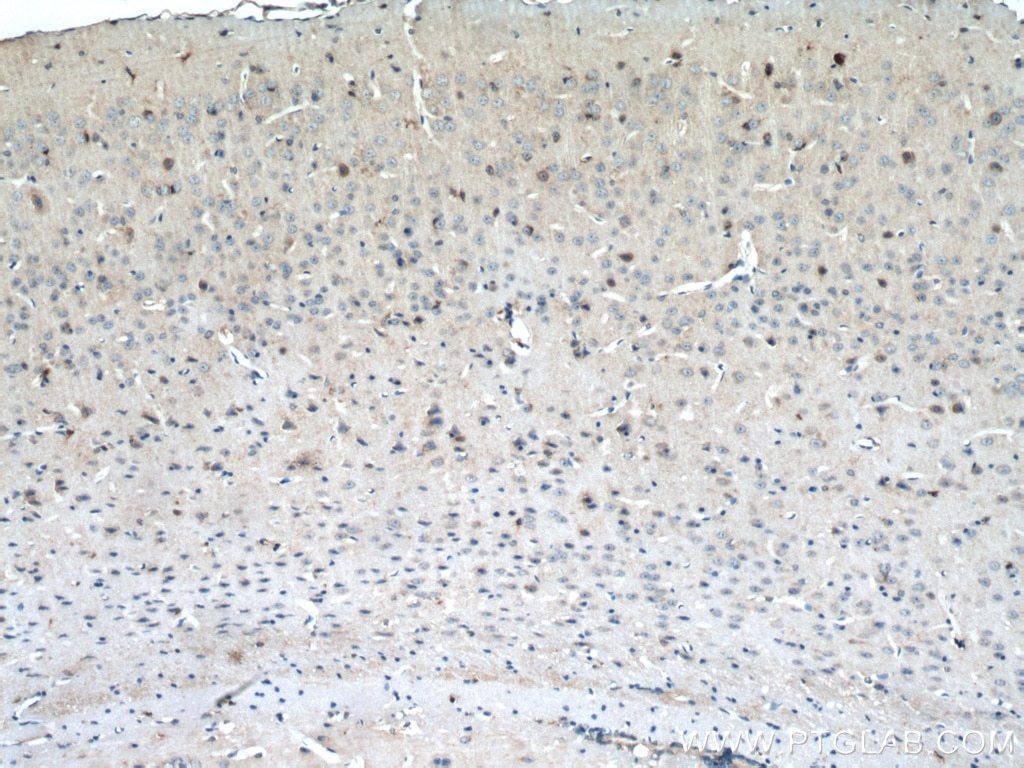 Immunohistochemistry (IHC) staining of mouse brain tissue using MTSS1L Polyclonal antibody (27832-1-AP)