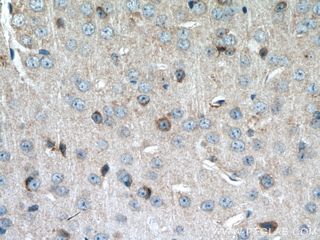 Immunohistochemistry (IHC) staining of mouse brain tissue using MTSS1L Polyclonal antibody (27832-1-AP)
