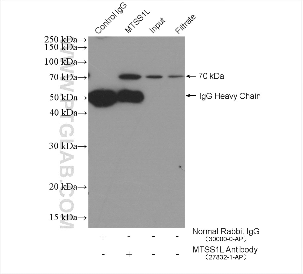 Immunoprecipitation (IP) experiment of Jurkat cells using MTSS1L Polyclonal antibody (27832-1-AP)