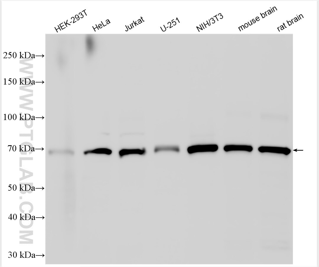 Western Blot (WB) analysis of various lysates using MTSS1L Polyclonal antibody (27832-1-AP)