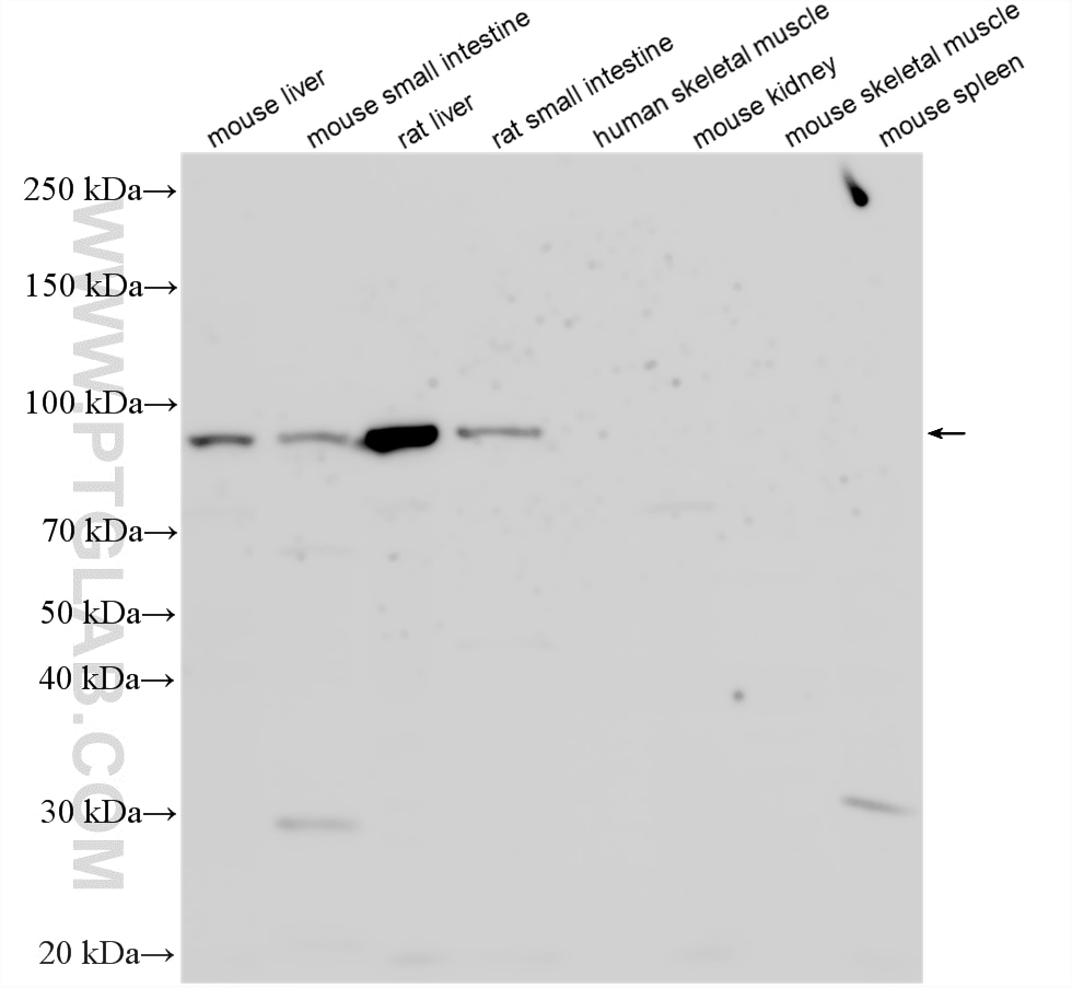 Various lysates were subjected to SDS PAGE followed by western blot with 23940-1-AP (MTTP antibody) at dilution of 1:1500 incubated at room temperature for 1.5 hours. Negative control: human skeletal muscle tissue, mouse kidney tissue, mouse skeletal muscle tissue, mouse spleen tissue. Western Blot (WB) analysis of various lysates using MTTP/MTP Polyclonal antibody (23940-1-AP)