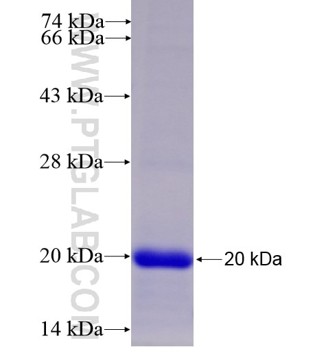 MTTP fusion protein Ag10131 SDS-PAGE