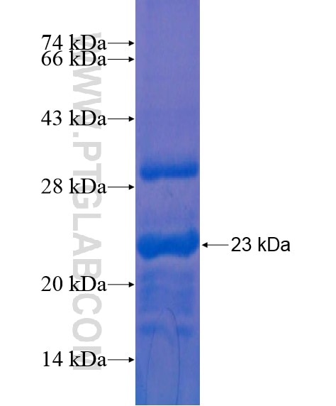MTTP fusion protein Ag21045 SDS-PAGE
