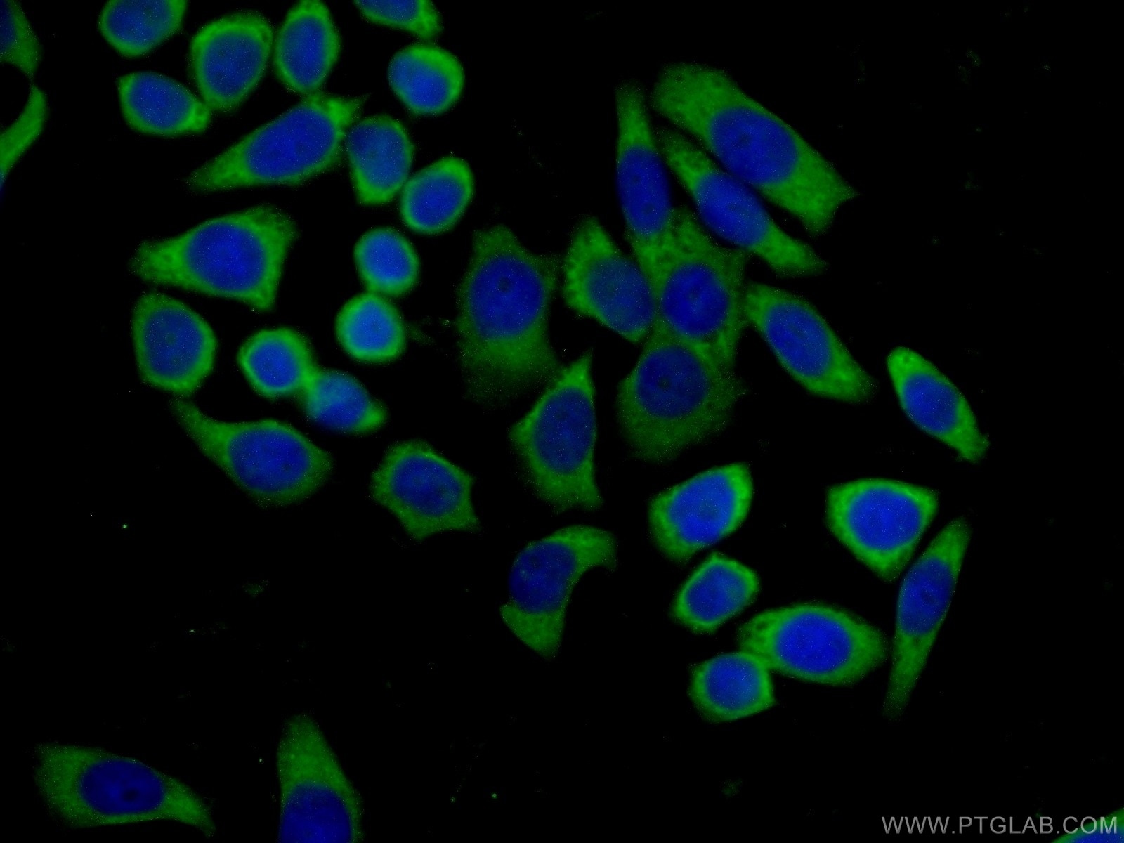 Immunofluorescence (IF) / fluorescent staining of PC-3 cells using MTUS1 Polyclonal antibody (13436-1-AP)