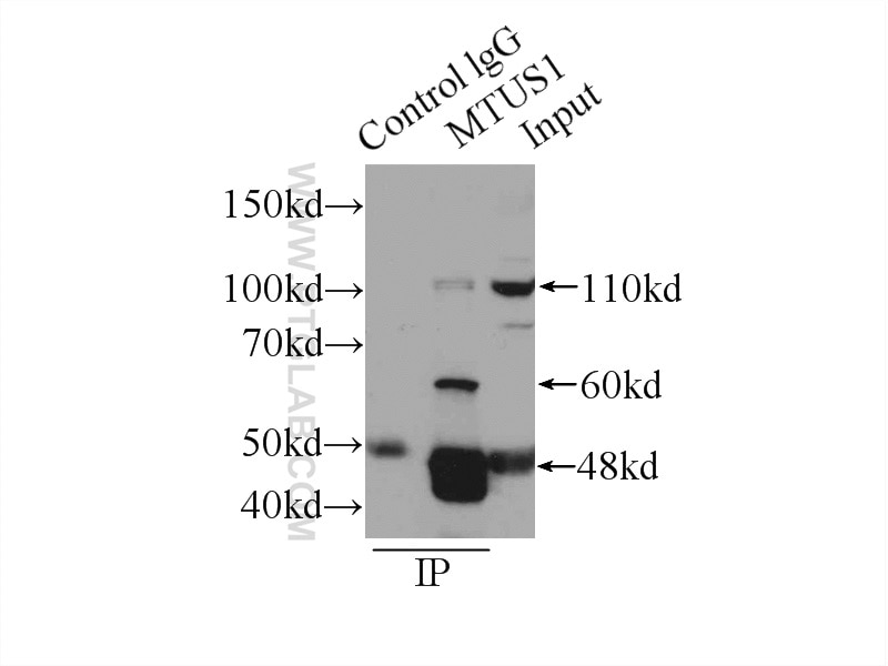 Immunoprecipitation (IP) experiment of mouse brain tissue using MTUS1 Polyclonal antibody (13436-1-AP)
