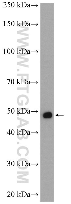 Western Blot (WB) analysis of mouse brain tissue using MTUS1 Polyclonal antibody (13436-1-AP)