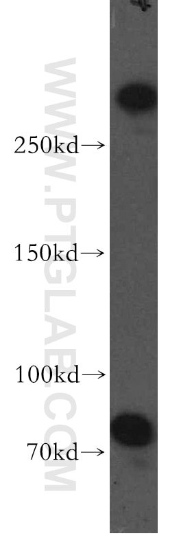 Western Blot (WB) analysis of human brain tissue using MTUS1 Polyclonal antibody (13436-1-AP)