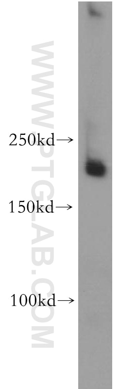 Western Blot (WB) analysis of human skeletal muscle tissue using MTUS1 Polyclonal antibody (18791-1-AP)