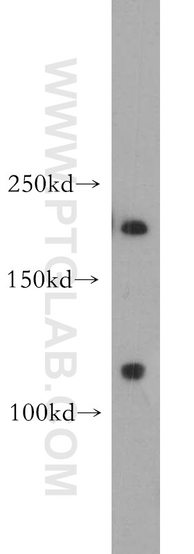 Western Blot (WB) analysis of human skeletal muscle tissue using MTUS1 Polyclonal antibody (18791-1-AP)