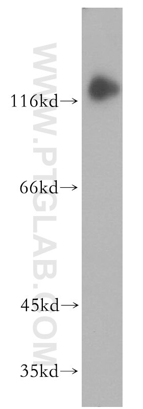 Western Blot (WB) analysis of mouse uterus tissue using MTUS1 Polyclonal antibody (18791-1-AP)