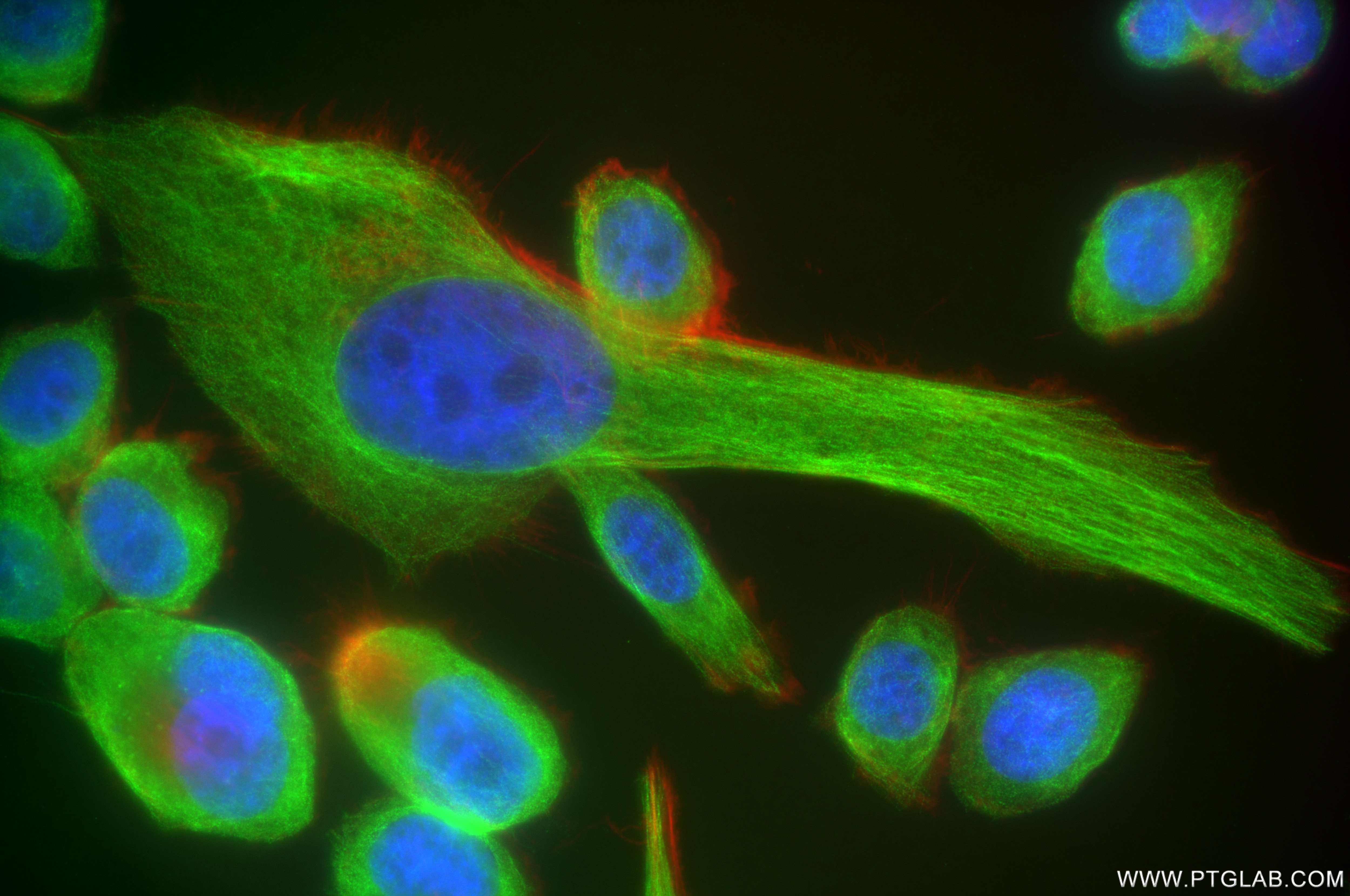 Immunofluorescence (IF) / fluorescent staining of PC-3 cells using MTUS1 Recombinant antibody (85117-4-RR)
