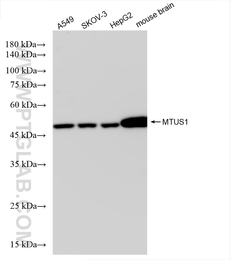 Western Blot (WB) analysis of various lysates using MTUS1 Recombinant antibody (85117-4-RR)