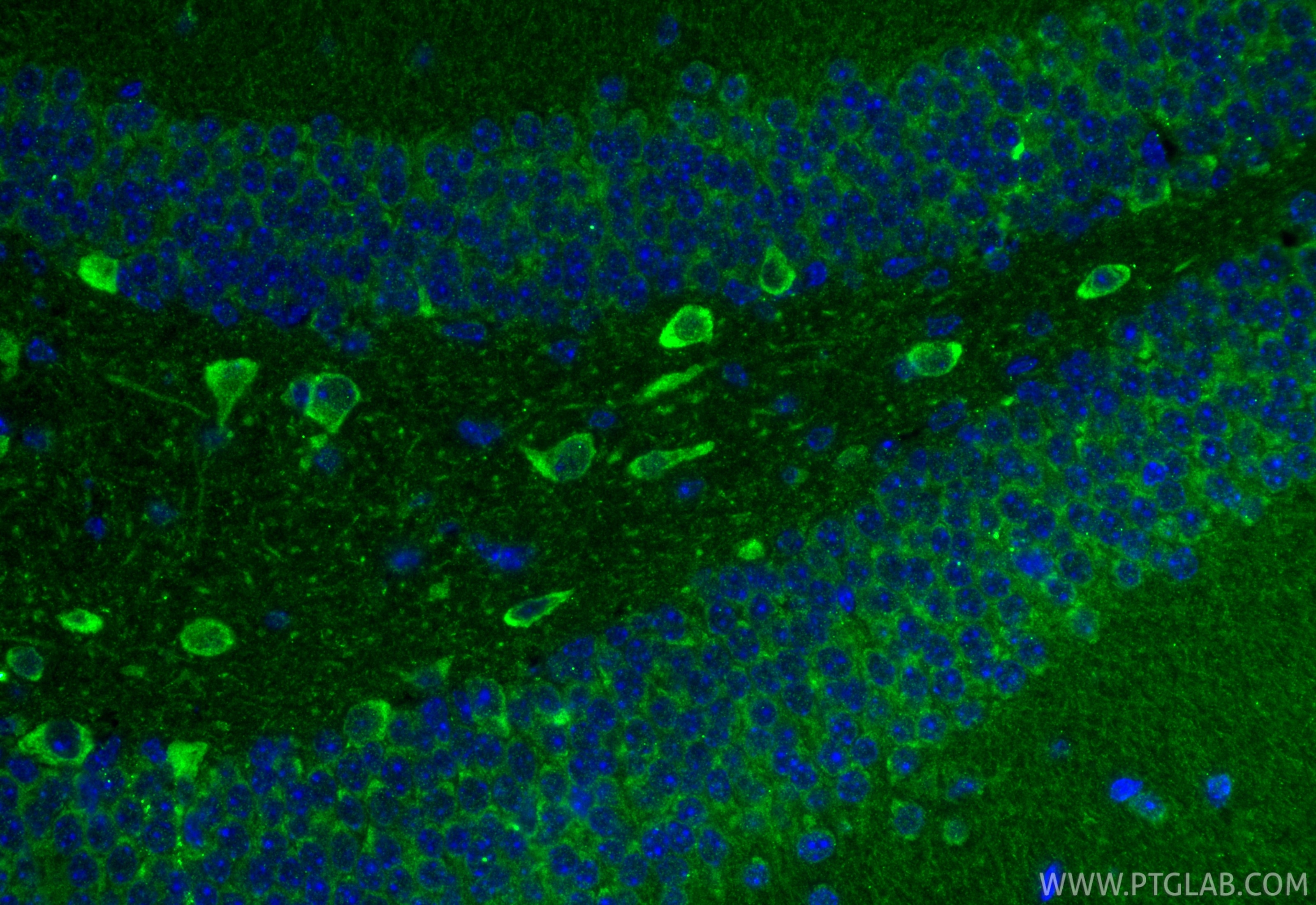 IF Staining of mouse brain using 15529-1-AP Immunofluorescence (IF) / fluorescent staining of mouse brain tissue using MTX1 Polyclonal antibody (15529-1-AP)
