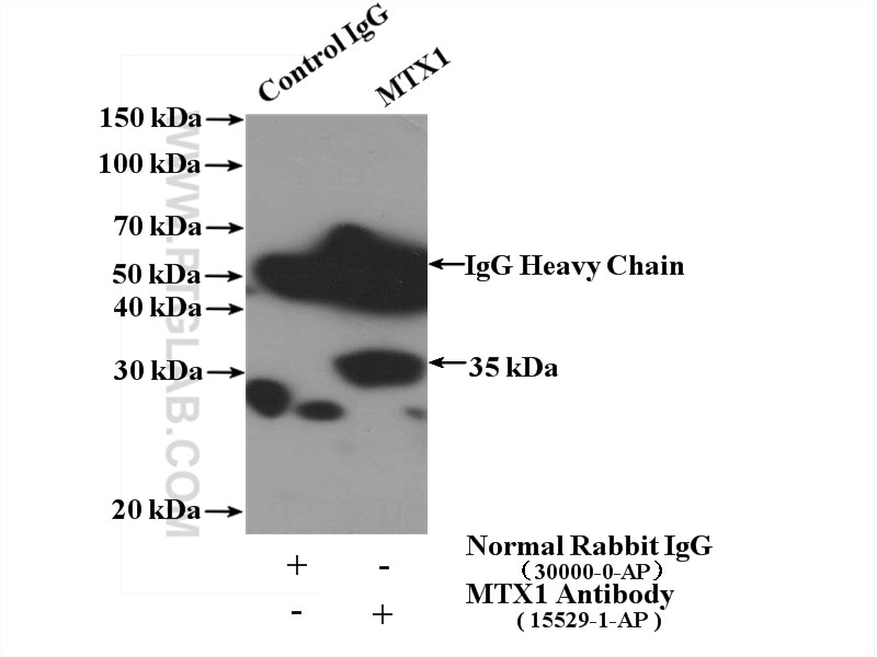 Immunoprecipitation (IP) experiment of MCF-7 cells using MTX1 Polyclonal antibody (15529-1-AP)