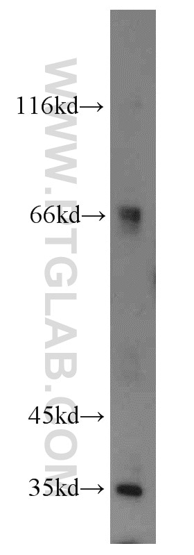 MTX1 Polyclonal antibody