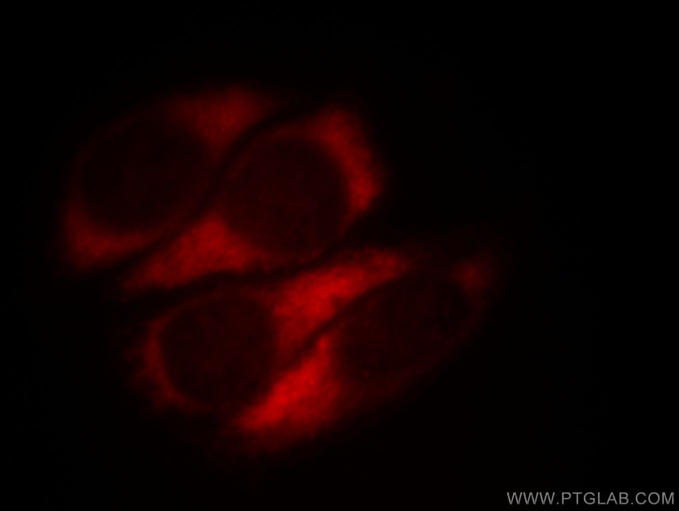 Immunofluorescence (IF) / fluorescent staining of HepG2 cells using MTX2 Polyclonal antibody (11610-1-AP)