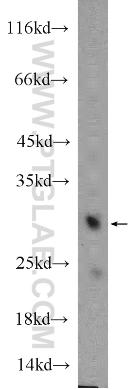 Western Blot (WB) analysis of rat heart tissue using MTX2 Polyclonal antibody (11610-1-AP)