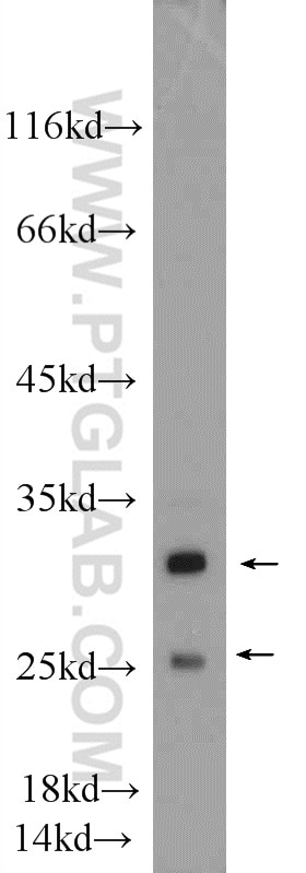 Western Blot (WB) analysis of mouse heart tissue using MTX2 Polyclonal antibody (11610-1-AP)